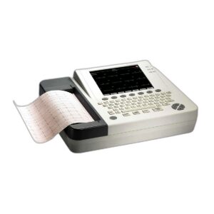 Electrocardiogram (ECG/EKG)