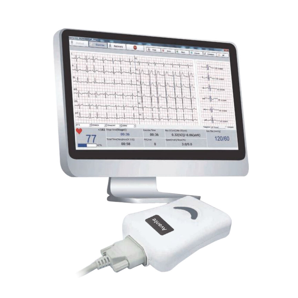 avante-velocity-ekg-monitor